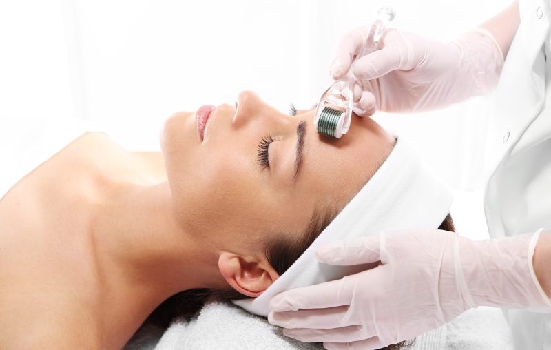 L'eterna giovinezza - microneedling a Potenza